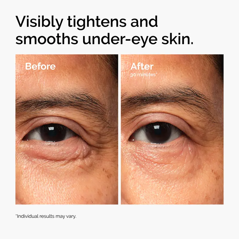 Lacto-PDRN* 4% + B9 Eye Cream