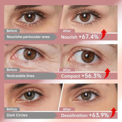 Deep Collagen Eye Patch – Glass Glow Korean Skincare Mask for Lift & Brightening, Depuffs Under-Eye Bags 🚨 70% OFF · Ending in 3 Hours