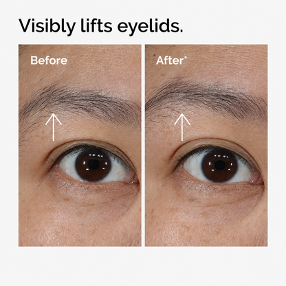 Lacto-PDRN* 4% + B9 Eye Cream